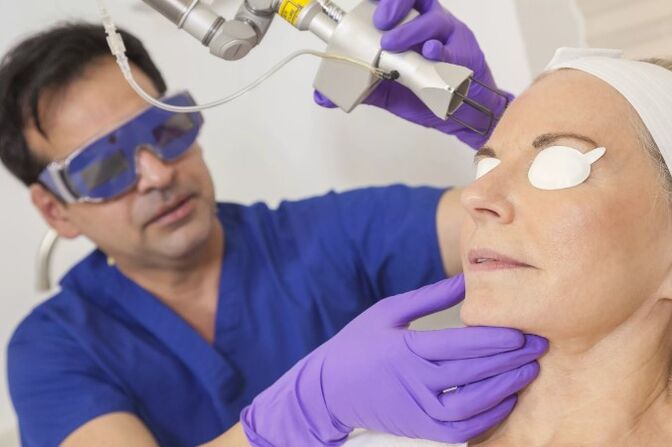 Pomlajevanje kože z laserjem